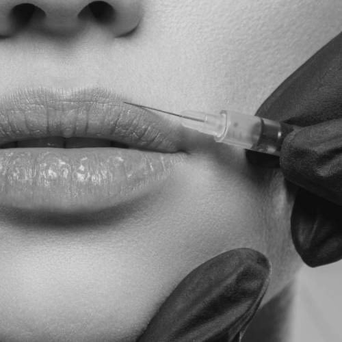 Black and white close crop of a mouth with a fine syringe held to the upper lip border by a gloved hand.